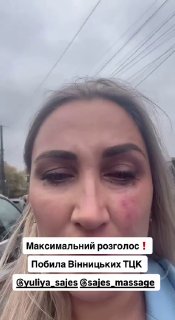 In Vinnytsia woman blocked TCK minibus and helped man escape